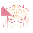 icon-breast-cancer-calculator